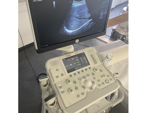 Esaote mylab x6 ultrasound machine